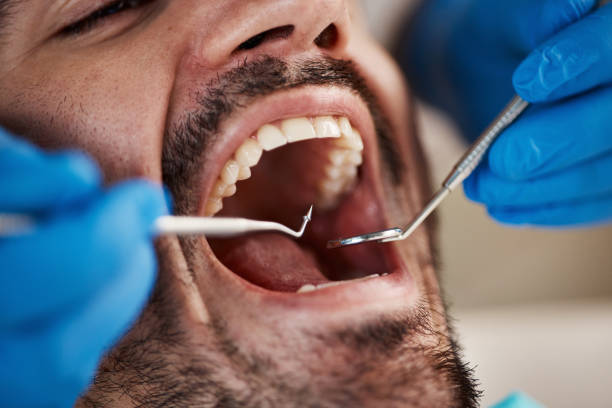 Best Wisdom Tooth Removal  in Rochelle, IL